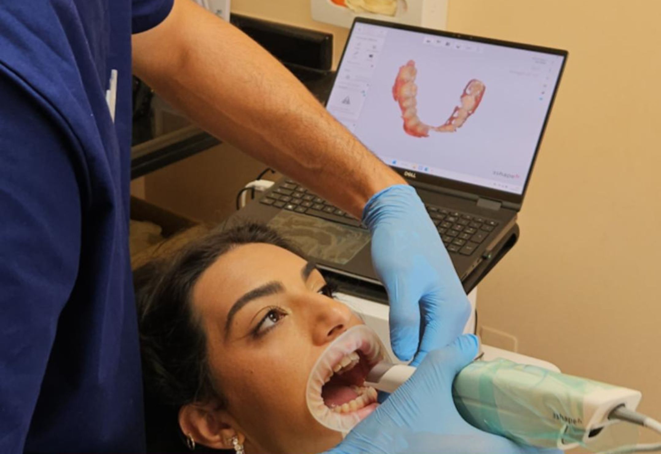 Il Dr. Stefano Pagnoni rileva le impronte dentali con scanner digitale
