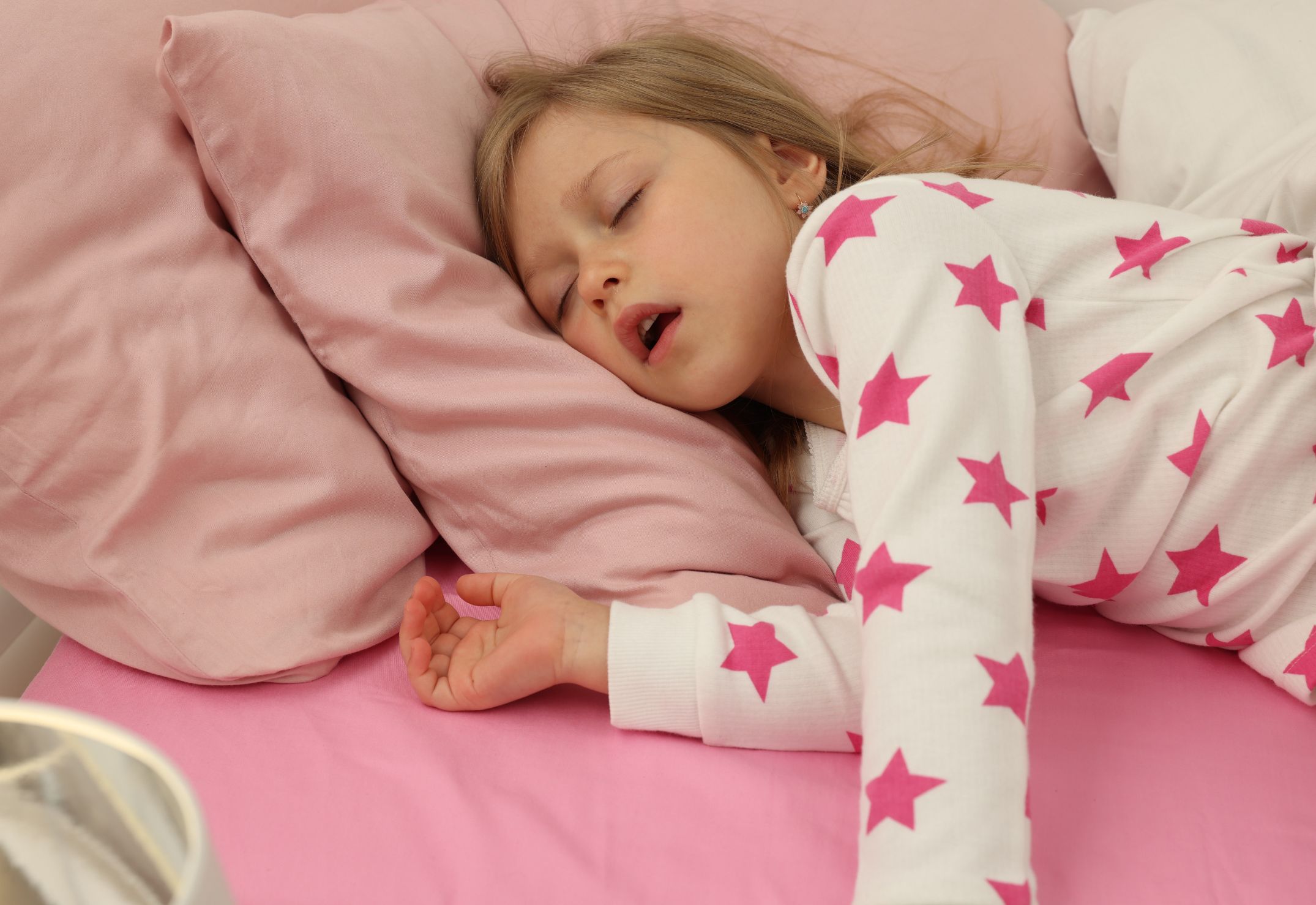 Bambina dorme con bocca aperta respirando in modo inadeguato