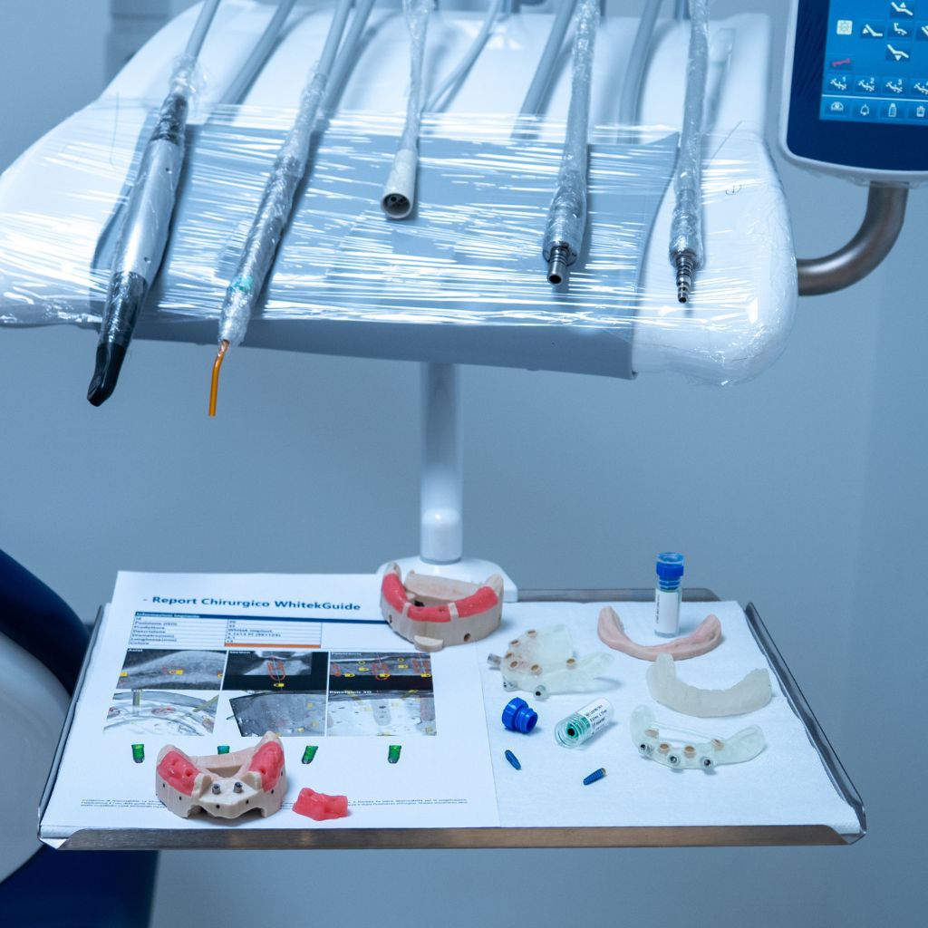 Impianti Dentali Digitali